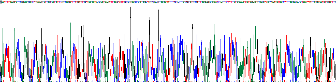 Recombinant Carbamoyl Phosphate Synthase 1, Mitochondrial (CPS1)