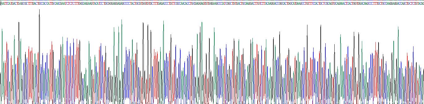 Recombinant Four And A Half LIM Domains Protein 2 (FHL2)