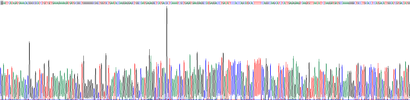 Recombinant Cat Eye Syndrome Chromosome Region, Candidate 1 (CECR1)