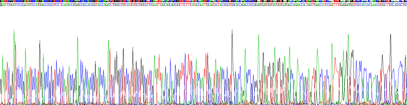 Recombinant Steroid 5 Alpha Reductase 2 (SRD5a2)