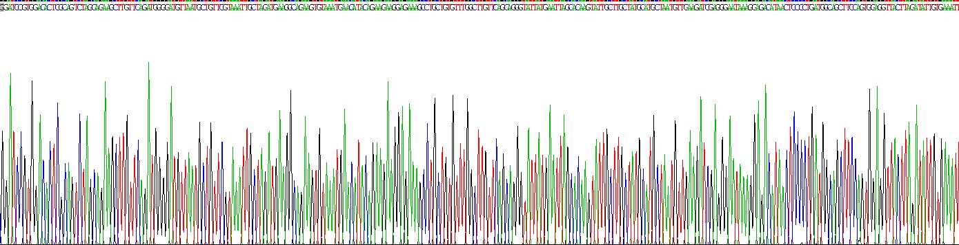 Recombinant Ankyrin Repeat And KH Domain Containing Protein 1 (ANKHD1)