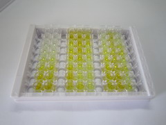 ELISA Kit for Cytochrome P450 11B1 (CYP11B1)