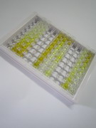 ELISA Kit for Alcohol Dehydrogenase 3 (ADH3)