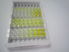 ELISA Kit for Melanoma Antigen Family B16 (MAGEB16)
